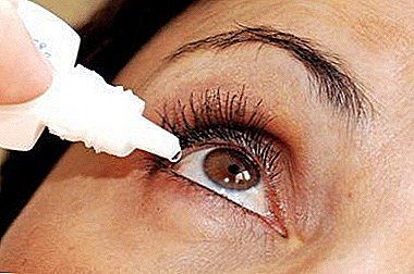 Како да се користи борна киселина за испирање очи?
