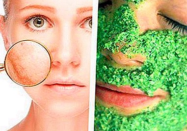 Maskat zbardhues të majdanozit dhe tonikave nga lëngu i gjelbër për fytyrën: si të gatuaj dhe të aplikoni pikat e pigmentit?