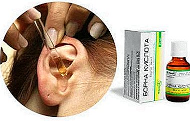 'N Eenvoudige middel: is dit moontlik om boorsuur in die oor te druppel? Kontraindikasies en duur van behandeling